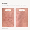 image:imageNood Serum  After Shave to Prevent Ingrown Hair amp Slow Regrowth 33oz33 Fl Oz Pack of 1