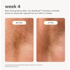 image:imageNood Serum  After Shave to Prevent Ingrown Hair amp Slow Regrowth 33oz33 Fl Oz Pack of 1