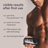 image:imageNEW Nood Flasher 20 Kit  IPL Laser Hair Removal Device for Women amp Men  Painfree amp Permanent Visible Results After First Use amp Works Everywhere  Pre amp Post IPL Treatment Included  Matte Black